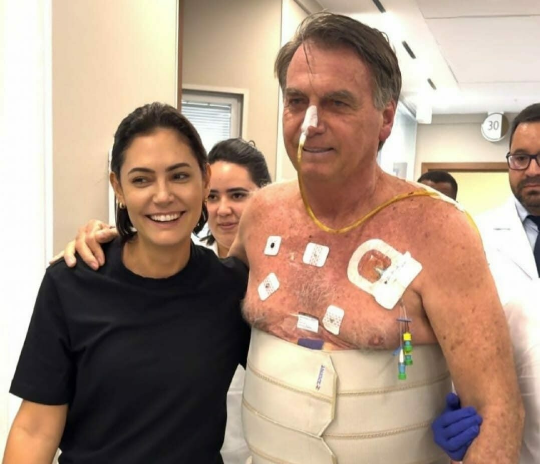 Michelle Bolsonaro diz que ex-presidente está há seis dias sem soluços